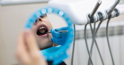 Root Canal Treatment in London